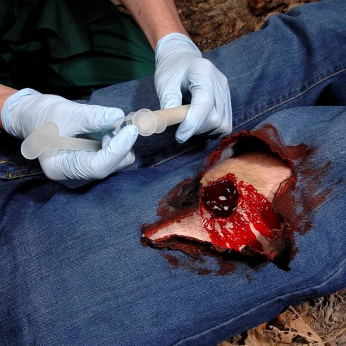 Аппликатор гемостатический с гранулами Rhino Rescue в Нижнекамске хитозановый